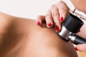 Leia mais sobre o artigo Como prevenir o câncer de pele: 5 dicas importantes